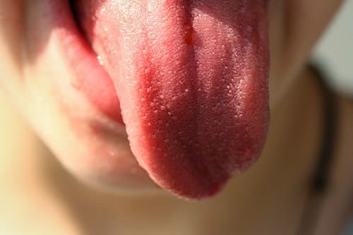 Taube Zunge – Was bedeutet das
